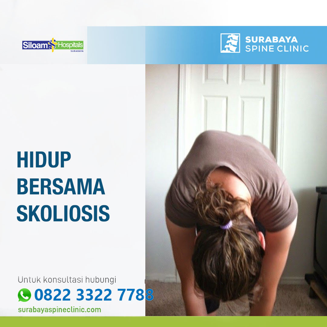 Solusi Skoliosis Bukan Halangan: Menjelajahi Klinik di Jakarta & Surabaya untuk Tulang Belakang